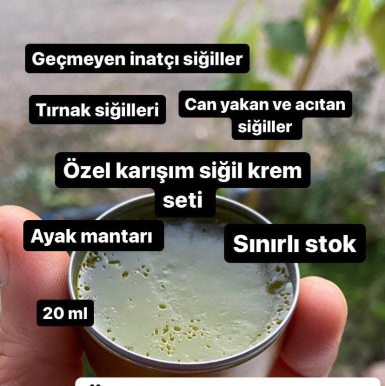 Siğil Seti 3 Lü